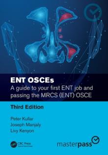 ENT OSCEs: A guide to your first ENT job and passing the MRCS (ENT) OSCE