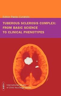 Tuberous Sclerosis Complex: From Basic Science to Clinical Phenotypes