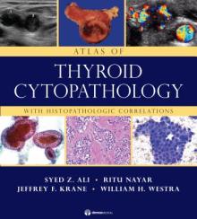 Atlas of Thyroid Cytopathology: With Histopathologic Correlations
