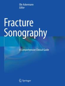 Fracture Sonography: A Comprehensive Clinical Guide