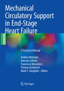 Mechanical Circulatory Support in End-Stage Heart Failure: A Practical Manual