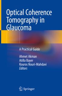 Optical Coherence Tomography in Glaucoma: A Practical Guide